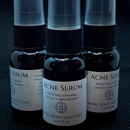 acne serum